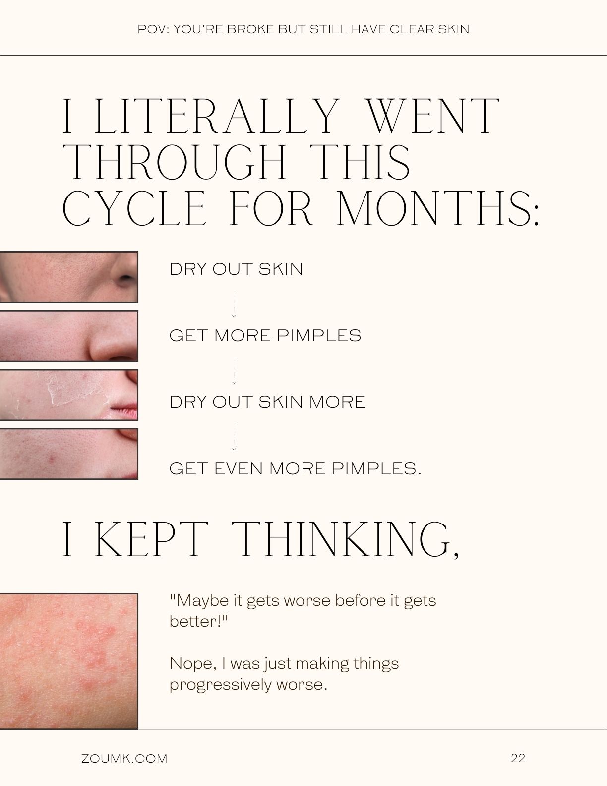 POV You’re broke but still have CLEAR SKIN, & now people DEMAND you to spill the tea. (15 Dirt CHEAP DIY Skin Care Tips for Acne) zoumk.com