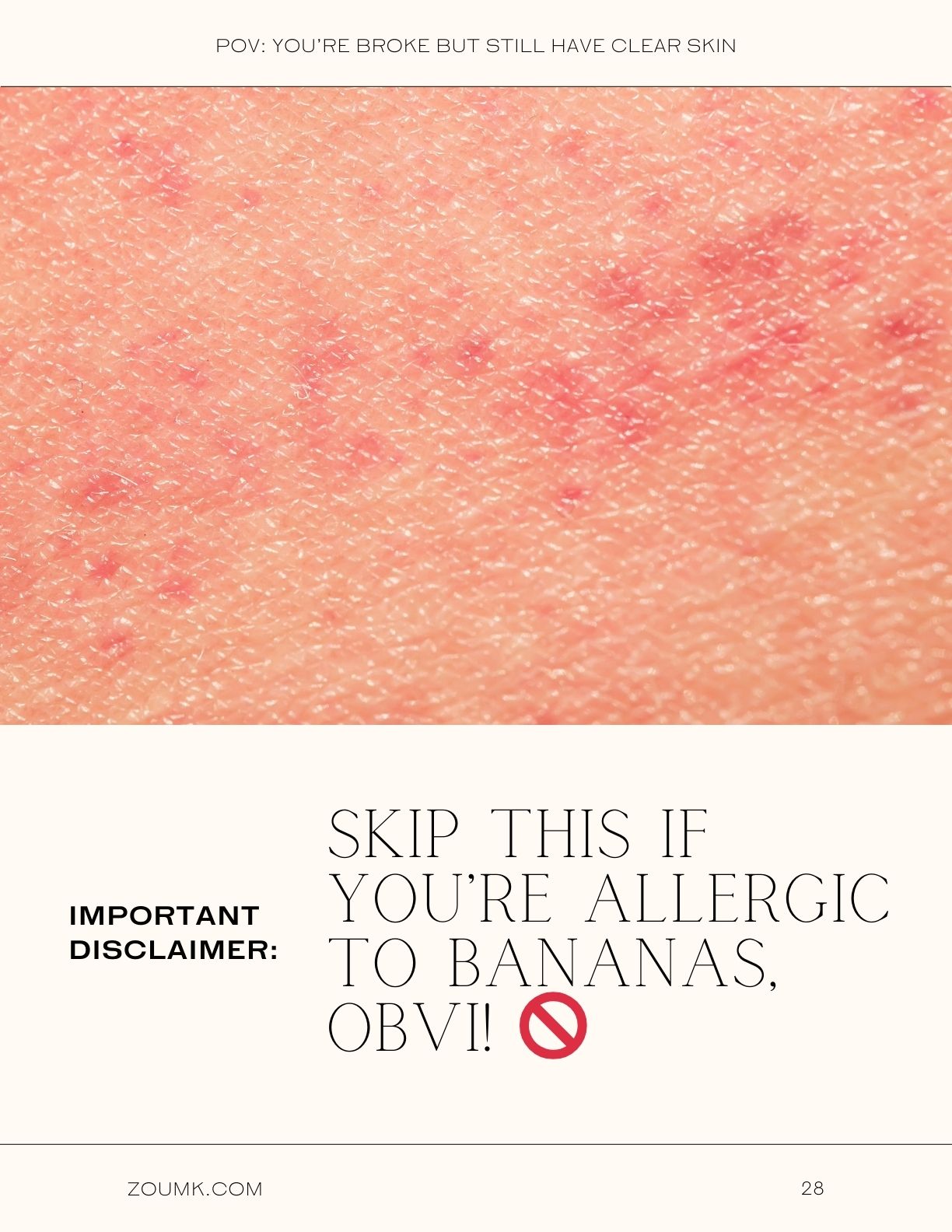 POV You’re broke but still have CLEAR SKIN, & now people DEMAND you to spill the tea. (15 Dirt CHEAP DIY Skin Care Tips for Acne) zoumk.com